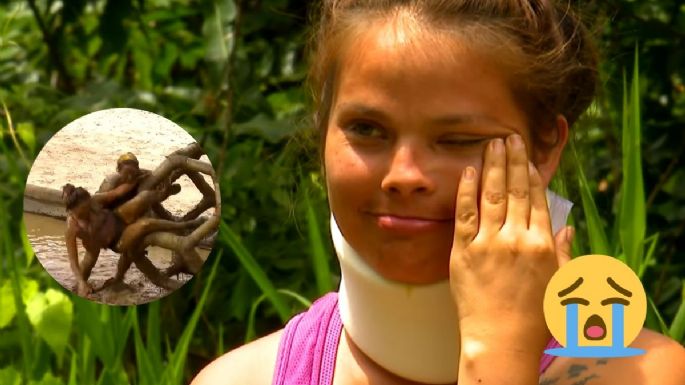 Survivor México: Así fue la TERRIBLE lesión que dejó a Fátima fuera de la competencia | VIDEO