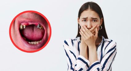 ¿Qué significa que sueñes que se te caen los dientes?