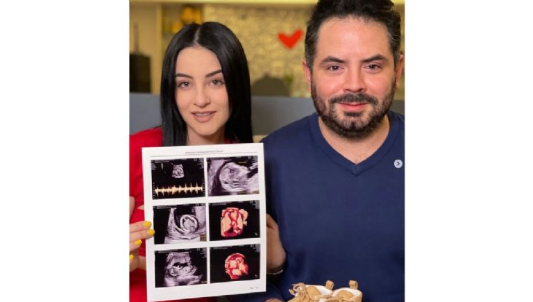 josé eduardo derbez y su novia anuncian u embarazo
