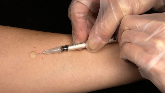 AstraZeneca suspende pruebas de vacuna por reacciones graves en paciente