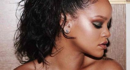 Rihanna preocupa a sus fans por lesiones en su rostro FOTOS