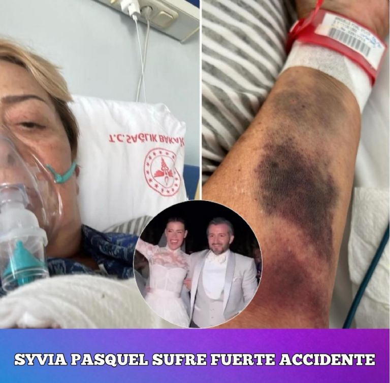 Sylvia Pasquel sufre un fuerte accidente y estas son las fotos