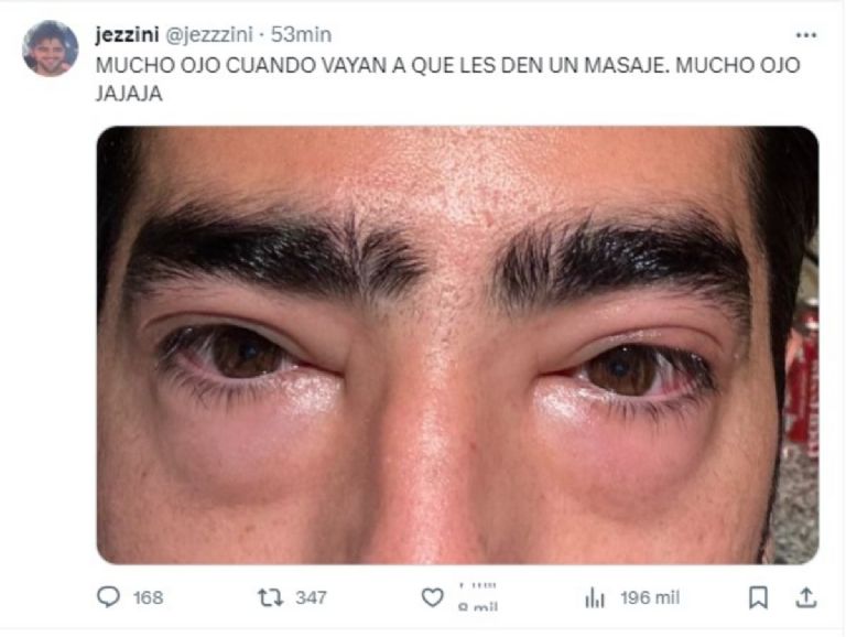 El viral creador de contenido Jezzini compartió fotos donde se ve mal su cara ¿Qué le ocurrió?