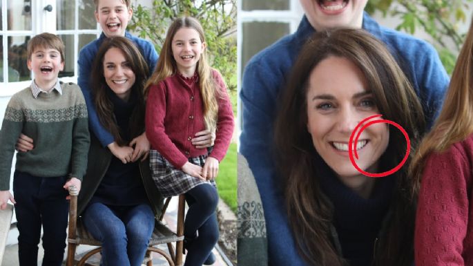 ¿Qué le pasó a Kate Middleton? Photoshop evidencia que algo no está bien con la princesa de Gales