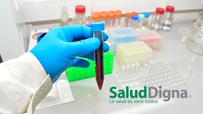 Paquete diabético en Salud Digna: precios, qué incluye y cuánto tardan en dar los resultados